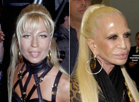 antonella versace prima e dopo